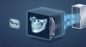 The New Imaging Is Bigger Than Your Server: What Dental MRI and AI-Cleared Modalities Demand From Your Practice IT